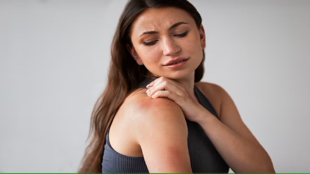 sodium,eczema,inflammatory condition,skin,study,fast food,Eczema symptoms, Eczema cure,