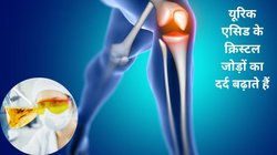 Uric Acid हाई होने से हड्डियों में बढ़ गया है दर्द और सूजन, इन 5 फूड्स को रोज़ाना खा लें, 10 दिनों में जड़ से खत्म हो जाएगा यूरिक एसिड