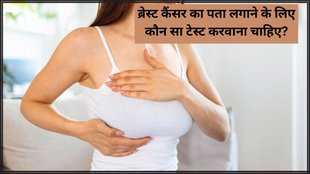 Breast Cancer । Breast Cancer Test । Mammogram