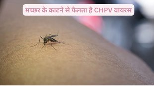 chandipura virus disease ,chandipura virus in gujarat,chandipura vesiculovirus ,what is chandipura virus ,chandipura virus symptoms in english,chandipura virus treatment