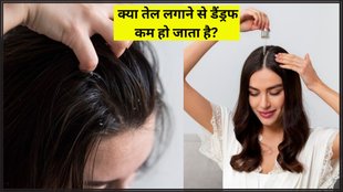 Hair Care । Dandruff । Hair Care Tips