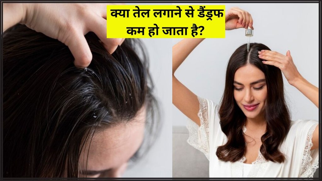 Hair Care । Dandruff । Hair Care Tips