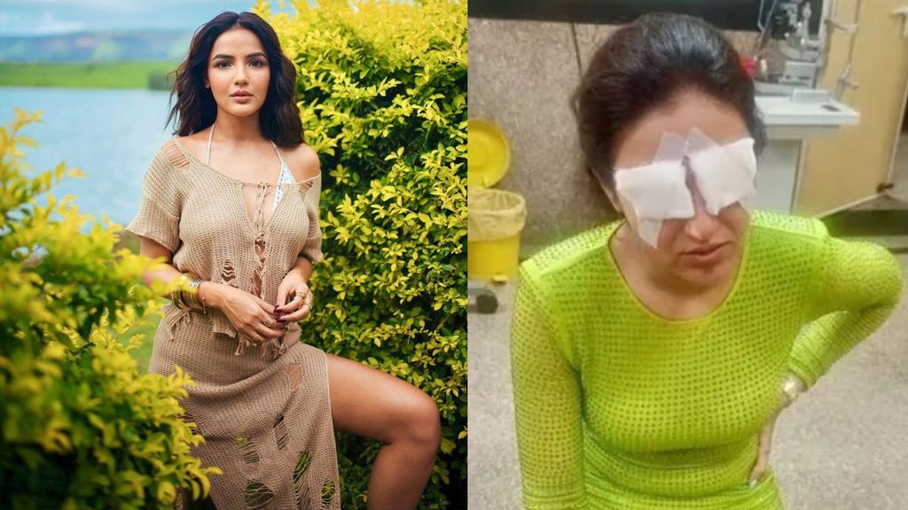Jasmin Bhasin । Contact lens side effects । Jasmin Bhasin Instagram