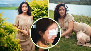 Jasmin bhasin, Jasmin bhasin Facing Eyes Issues, Jasmin bhasin Health issue