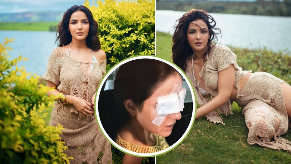 Jasmin bhasin, Jasmin bhasin Facing Eyes Issues, Jasmin bhasin Health issue Jasmin bhasin, Jasmin bhasin Facing Eyes Issues, Jasmin bhasin Health issue