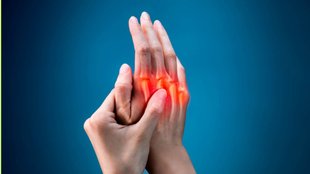 early signs of arthritis