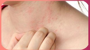 vitamin b6 deficiency causes bumps on skin