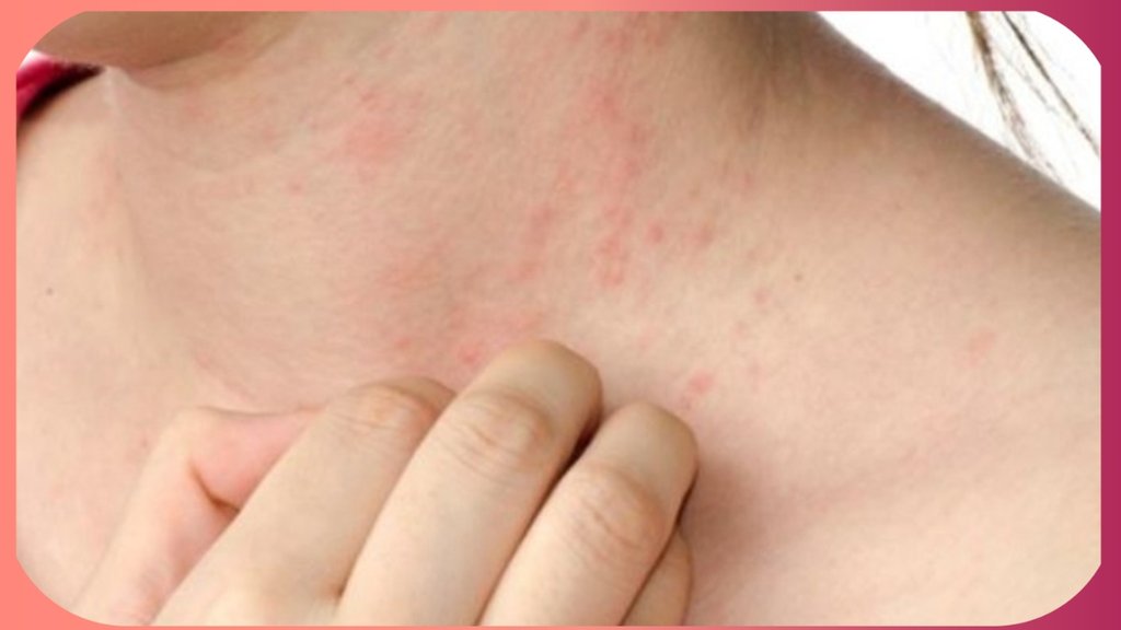 vitamin b6 deficiency causes bumps on skin