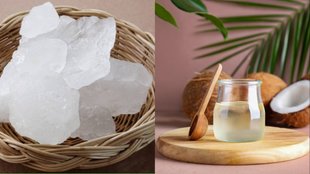 Coconut oil and fitkari for dandruff