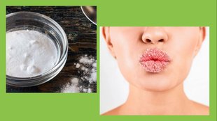 tips to remove dead cells on lips care