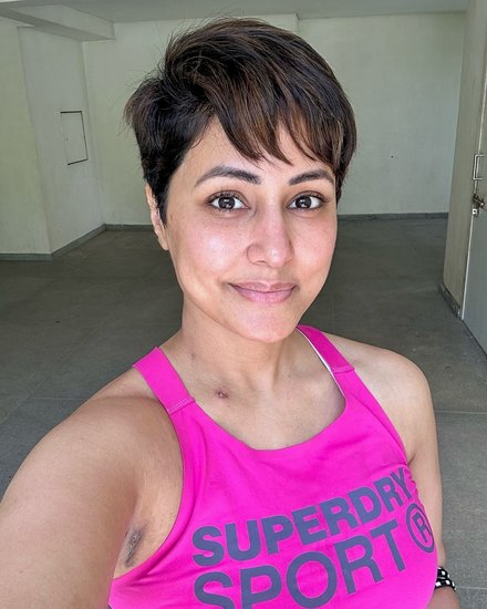 Hina Khan treatment scars