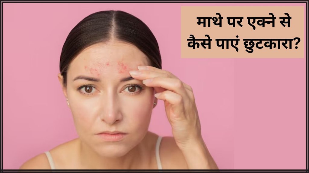 Forehead Acne । Forehead Acne Treatment । Forehead Pimple Treatment