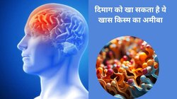 Brain Eating Amoeba: वाटर पार्क और स्वीमिंग करने वाले वाले हो जाएं सतर्क, ब्रेन को खा सकता है पानी का ये कीड़ा, जानिए इस बीमारी के लक्षण और बचाव