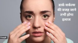 Eye Dark Circles: आंखों के नीचे डार्क सर्कल एजिंग प्रोसेस नहीं बल्कि इन 5 गंभीर बीमारियों के हो सकते हैं संकेत, कहीं आपको तो नहीं ये परेशानी?