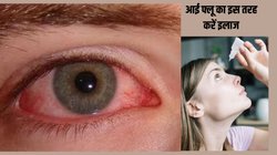 Conjunctivitis: आंखों में खून की तरह उतर आया है लाल रंग, झरने की तरह बह रहा पानी, बस इन 5 तरीकों से कर लें Eye Flu का इलाज