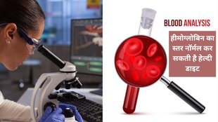 Hemoglobin Test,protein in red blood cells,hemoglobin test measures, how much hemoglobin is in your blood, Hemoglobin normal range,Hemoglobin Normal Range By Age, उम्र के हिसाब से हीमोग्लोबिन कितना होना चाहिए, Hemoglobin Normal Range By Age in Hindi,