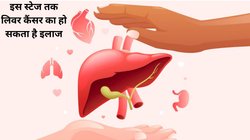 लिवर कैंसर का पहला संकेत क्या है? क्या इसका इलाज संभव है? liver Cancer की लास्ट स्टेज क्या है, एक्सपर्ट से जानिए सबकुछ