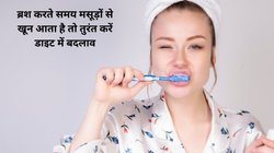 Gums Bleeding: क्या आपके मसूड़े भी काले होने लगे हैं और गम से निकल रहा है खून, इन विटामिन की कमी के हो सकते हैं लक्षण, जानें उपचार