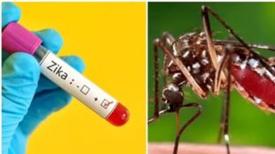 zika virus | Virus