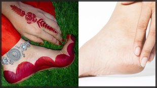 Crack Heels । Alta । Alta design । How to apply Alta