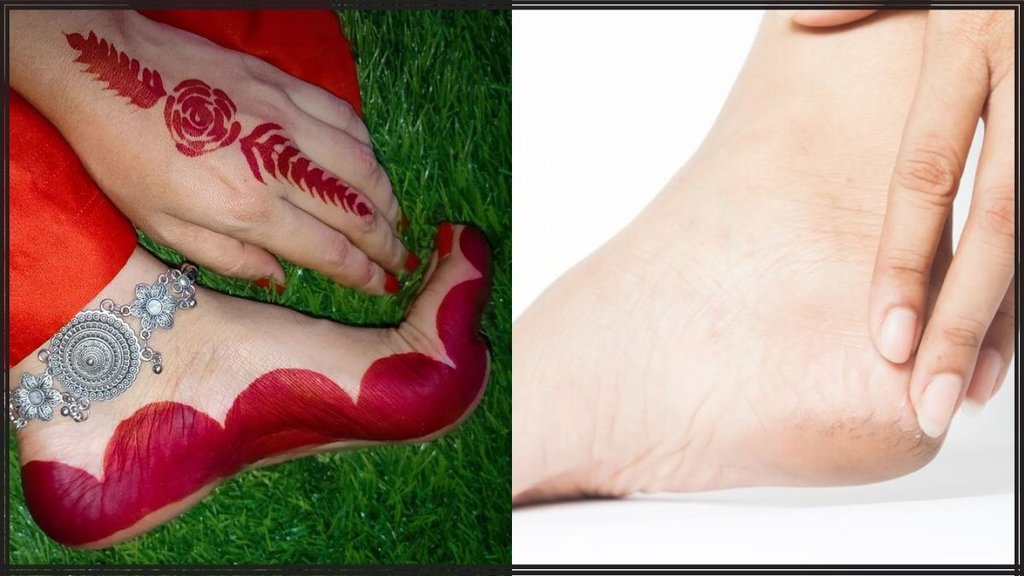 Crack Heels । Alta । Alta design । How to apply Alta