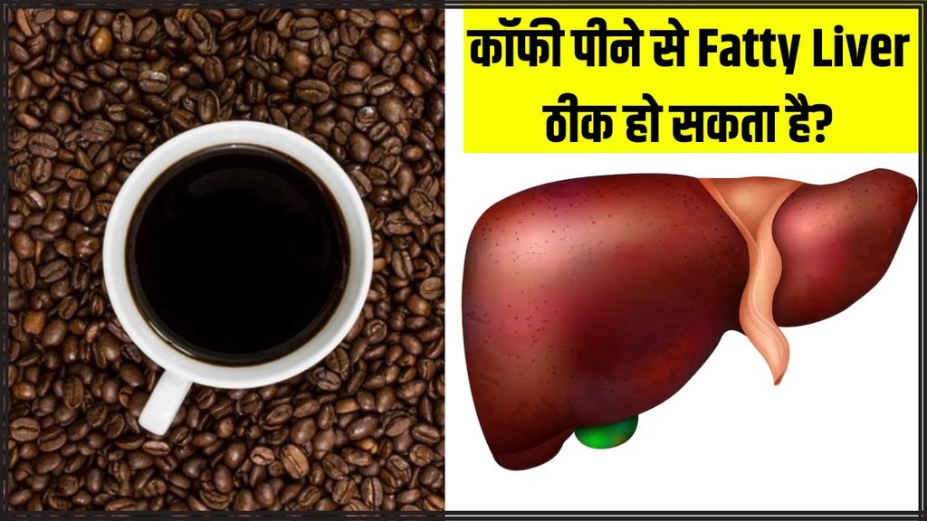 fatty liver । liver health । green tea for liver । coffee for liver