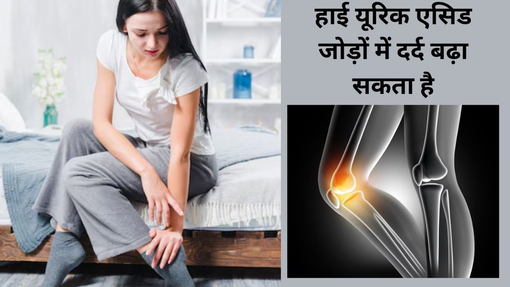 Uric Acid, uric acid control,uric acid control tips, how to control uric acid,Can uric acid be controlled by consuming 1 kiwi daily, Health benefits of kiwi