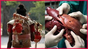Organ Donation Process । Kawar Yatra । Organ Donation Age