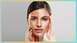 rubbing potato on face for sun tan and pigmentation