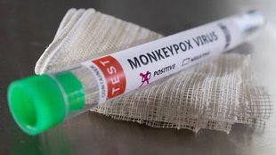 Monkeypox | WHO