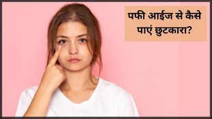Puffy Eyes Remedies । Puffy Eyes In Morning । Beauty Tips
