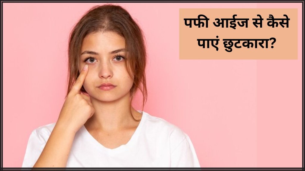 Puffy Eyes Remedies । Puffy Eyes In Morning । Beauty Tips