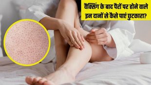 strawberry legs । strawberry legs treatment । strawberry legs treatment in Hindi