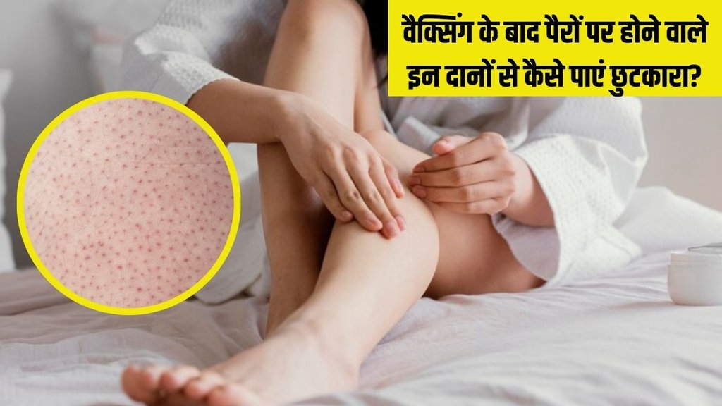 strawberry legs । strawberry legs treatment । strawberry legs treatment in Hindi