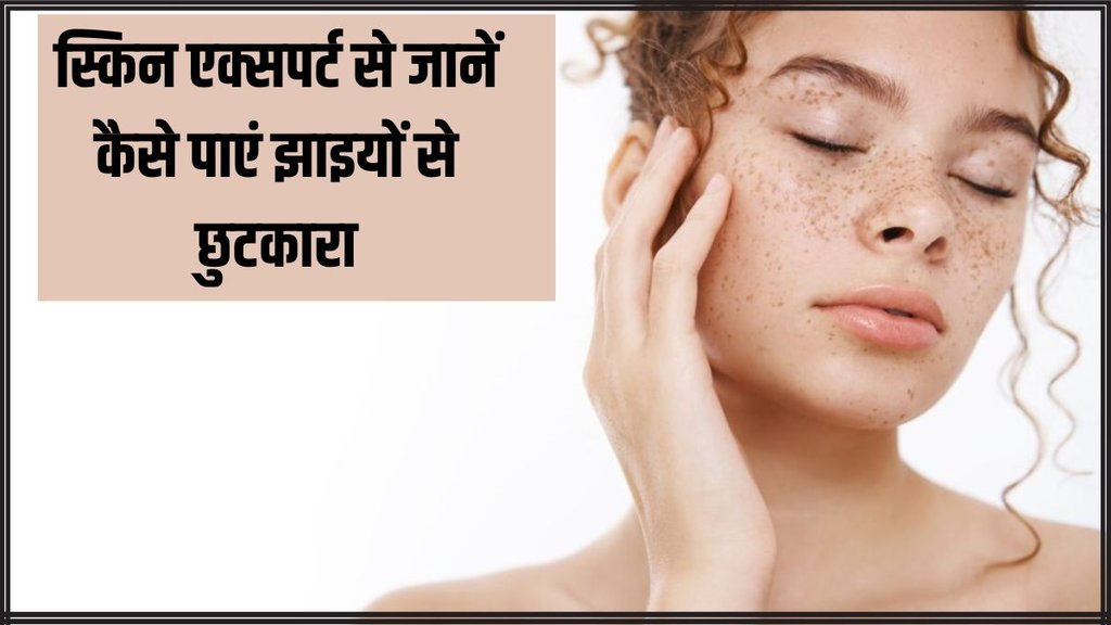 Skin Pigmentation । Skin Care । Pigmentation