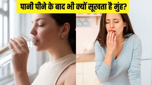 Dry mouth । diabetes । oral hygiene