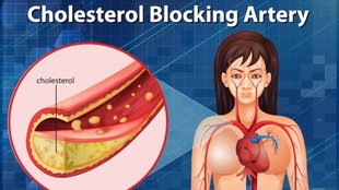 increase HDL cholesterol, heart-healthy breakfast, foods that raise good cholesterol, healthy breakfast ideas, oats for cholesterol, nuts and HDL levels, avocado and HDL,