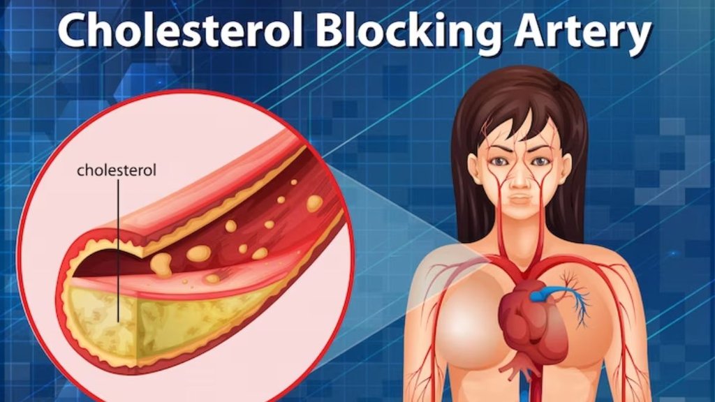 increase HDL cholesterol, heart-healthy breakfast, foods that raise good cholesterol, healthy breakfast ideas, oats for cholesterol, nuts and HDL levels, avocado and HDL,