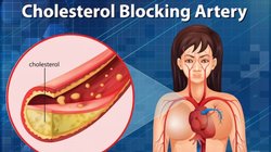 इन 5 फूड्स को खाने से बढ़ता है HDL कोलेस्ट्रॉल, Good Cholesterol से भरपूर ये फूड कैसे दिल के लिए हैं जरूरी, एक्सपर्ट से जानिए