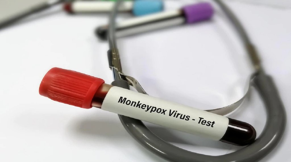 monkeypox vs smallpox, difference between monkeypox and smallpox, smallpox vaccine for monkeypox, monkeypox symptoms vs smallpox, how to prevent monkeypox,