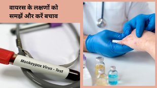 Monkeypox, Monkeypox Virus, WHO ,mpox viral infection, Monkeypox virus news, Monkeypox virus updates, mpox viral infection news, mpox viral case, Monkeypox case,मंकीपॉक्स, मंकीपॉक्स वायरस