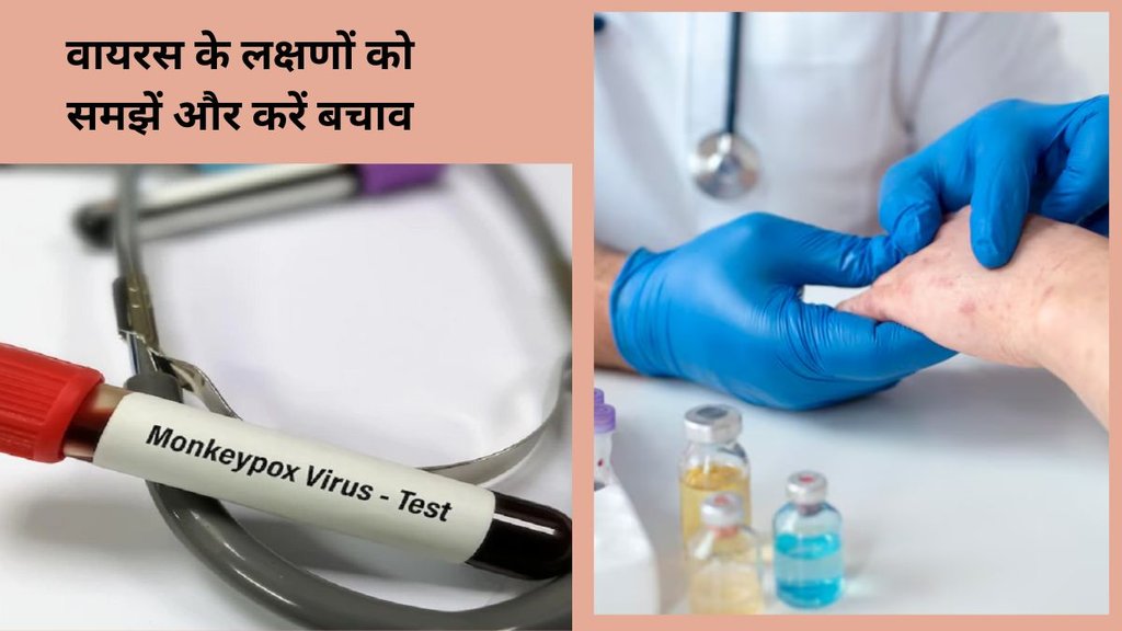 Monkeypox, Monkeypox Virus, WHO ,mpox viral infection, Monkeypox virus news, Monkeypox virus updates, mpox viral infection news, mpox viral case, Monkeypox case,मंकीपॉक्स, मंकीपॉक्स वायरस