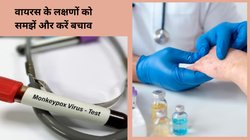 Monkeypox Virus: फ्लू जैसे दिखने वाले ये लक्षण मंकी पॉक्स तो नहीं? WHO ने किया अलर्ट, जानिए कैसे करें लक्षणों की पहचान और बचाव