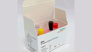 monkeypox | test kit | health |