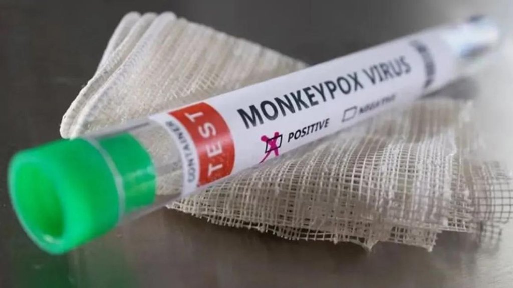 monkeypox virus | vaccine | serum institute |