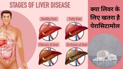 क्या Paracetamol का इस्तेमाल करने से liver Damage होने का खतरा बढ़ सकता है, रिसर्च से जानिए सच्चाई