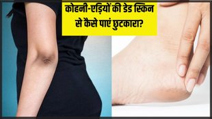 skin care । Dead skin On Knee । Dead skin On elbow