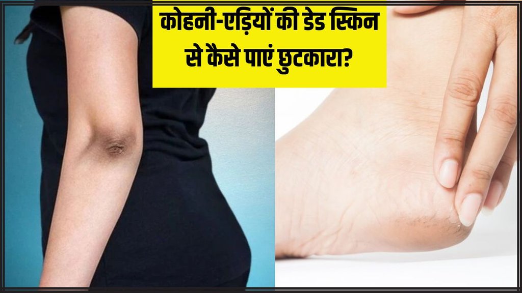 skin care । Dead skin On Knee । Dead skin On elbow