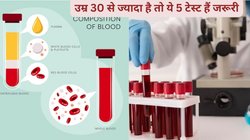 आपकी सेहत के सारे राज़ खोल देते हैं ये 5 टेस्ट, साल में 1 बार जरूर करा लें, टल सकता है बड़ा खतरा
