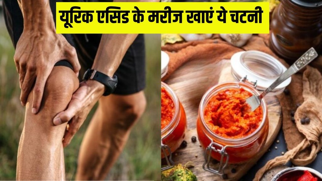 Uric Acid । Uric Acid Remedies । Uric Acid Home Remedies । Garlic For Uric Acid